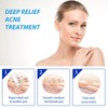 Crema para Manchas Oscuras en La Cara, Cremas para Quitar