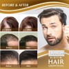 탈모 치료/머릿결개선/모발 강인화, 20ml, 1개 Hair Loss Treatment / Hair