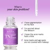 Tranexamic Acid 5% Serum with Niacinamide 5% for Face/Neck -