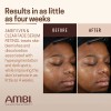 Serum Ambi Retinol Ácido Hialurónico Antimanchas Todo Tipo de Piel
