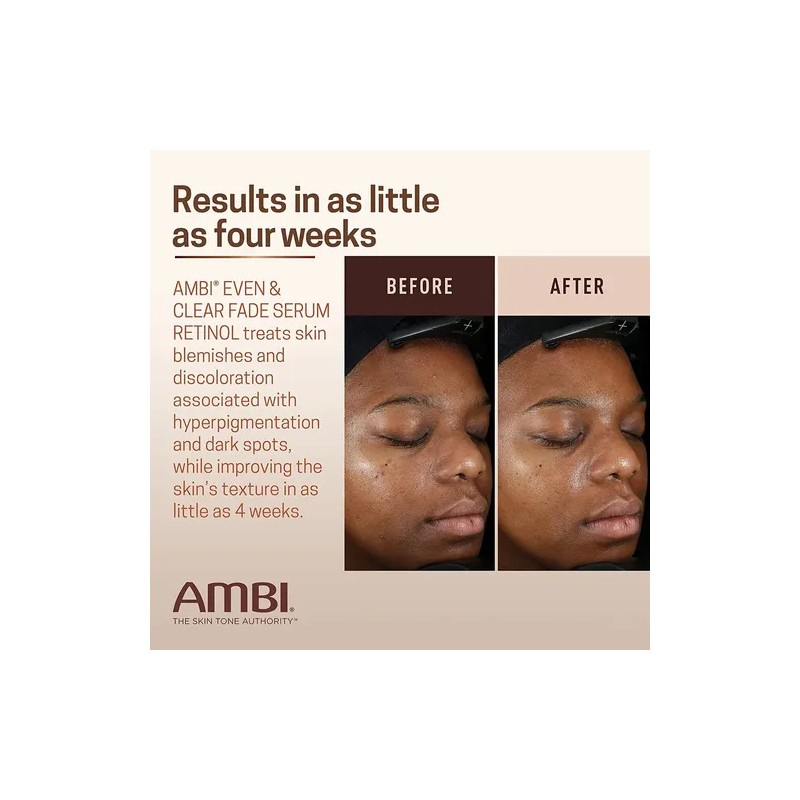Serum Ambi Retinol Ácido Hialurónico Antimanchas Todo Tipo de Piel