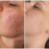 Crema Revitalizadora De Noche Todo Tipo De Piel Noche