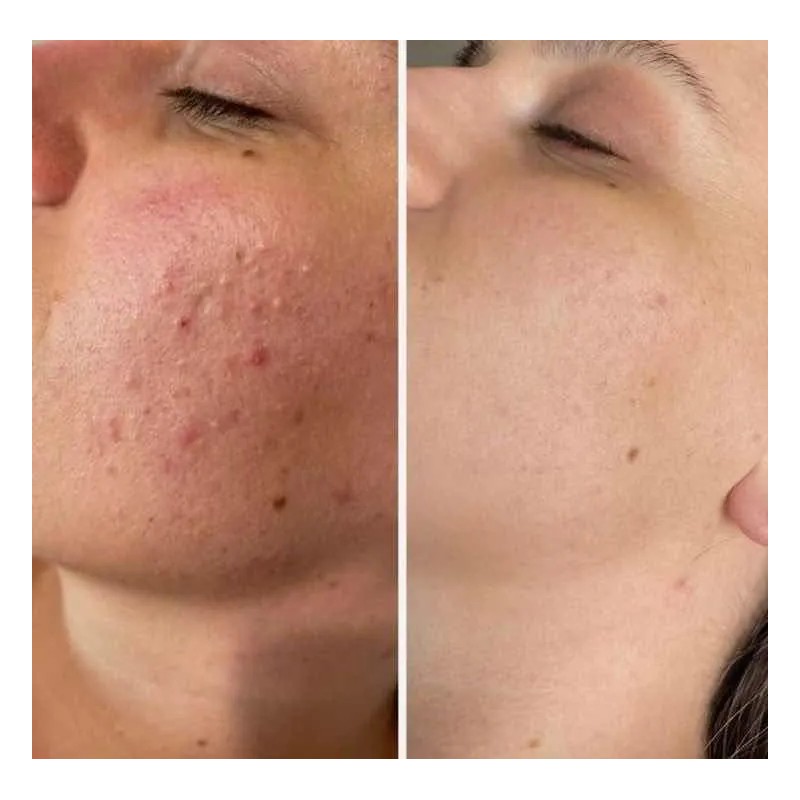 Crema Revitalizadora De Noche Todo Tipo De Piel Noche