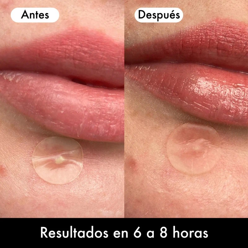 Hero Mighty Patch Invisible+ 48 Parches Antiacné Día Todo Tipo