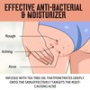 KOAHDE The Butt And Thigh Area,Butt Pimple Removing Cream,Reduce Acne
