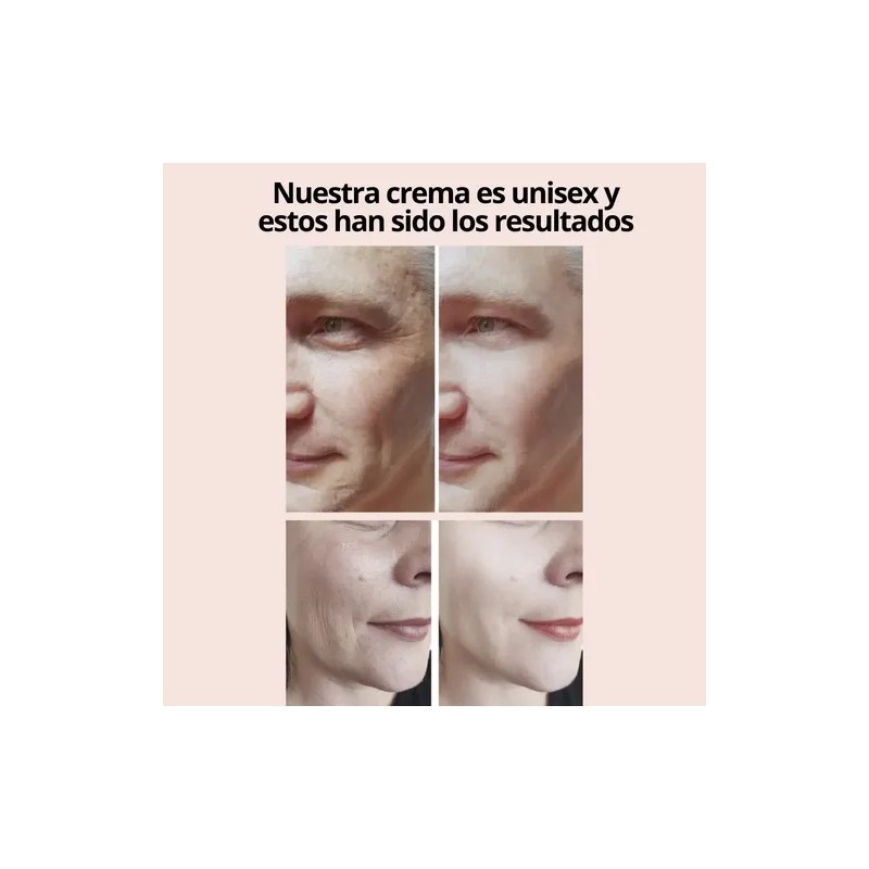 2 Cremas Facial Antiedad Y Antiojeras Con Ácido Hialurónico