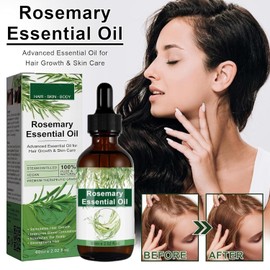 Aceite de Romero para Crecimiento y Tratamiento Capilar, Gotero para Estimular el Crecimiento del Cabello y Prevenir la Caída, 60ML/2.2 Fl Oz (2 Unidades)