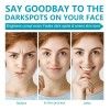 Eliminador De Manchas Oscuras Para Rostro Y Cuerpo