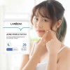 Parches Faciales Antiacné Universo en Linea Hipoalergénicos 25 Piezas
