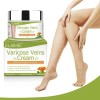 50 Ml De Pomada For Varices Elimina Las Estrías Rojas