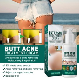 Butt Acne Cream, Anti Pimple Cream on the Buttocks, Butt Acne Cream, Butt Anti-Pimple Serum, Acne Cream for the Buttocks, Butt Pimple Removal Cream, Restore Soft and Smooth Butt Skin, 100 ml (A)