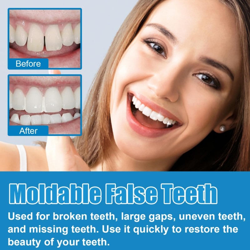 Temporary Tooth Filling Repair Kit - Moldable Tooth Repair Beads