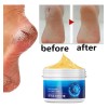 Crema Antisequedad Para Reparar Las Grietas De Los Pies Y