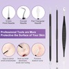 Pimple Popper Tool Kit,10 Pcs Professional Blackhead Remover Comedones Extractor
