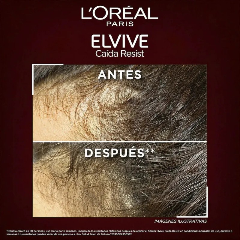 L'Oréal Paris - Shampoo Elvive L'Oreal Paris Antifall, con Aminexil