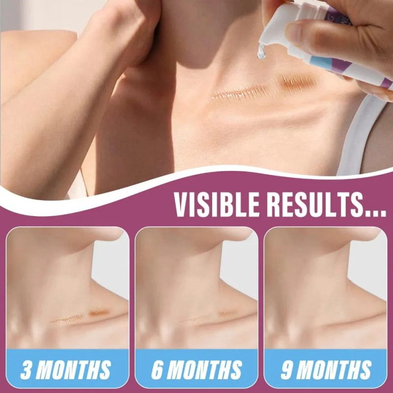 Scar Gel Vogsig Reparador Piel Reducción De Marcas Hidrata Mixta