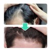 VT [Basic] VT PDRN Liddle Shot Scalp Ampoule 5 Bottles
