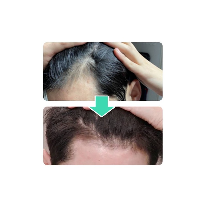 VT [Basic] VT PDRN Liddle Shot Scalp Ampoule 5 Bottles
