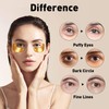 CHMI Under Eye Patches (50 Pairs) - 24K Gold Eye