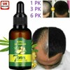 Revitalize in 7 Days: Ginger Germinal Hair Growth Serum - Nourishing Oil Treatment for Hair Regrowth-1 Pack