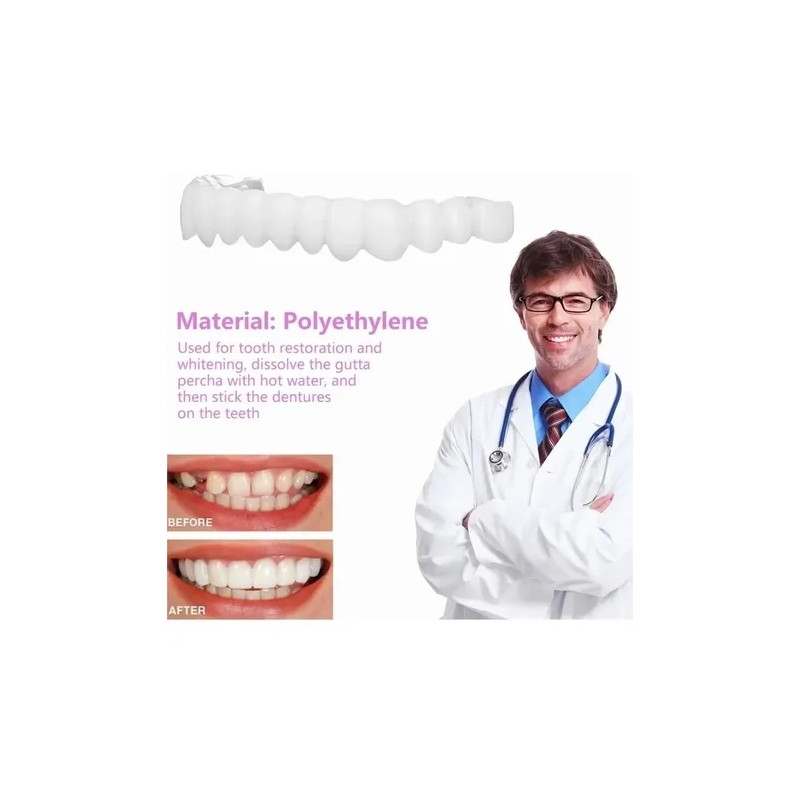 Carillas Estéticas Snap On Smile Veneers Dientes Temporales