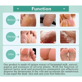 Pedi Bliss Foot Peel Mask 2 pack - Exfoliating Peeling Away Calluses and Dead Skin Cells For Men & Women - Moisturizing - Remove Dead Skin,Calluses & Cracked Heels (Coconut)