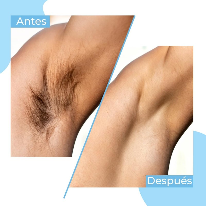 Cera para Depilar Ultramo Jazmín – Suave y Duradera