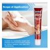 Xt ! Crema Anticongelante Anticongelante For Manos Y Pies /
