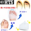 HTS 驚くような！ 外反母趾 サポーター 健康足指 足底筋膜炎 ウオノメ タコ マメ 底まめ