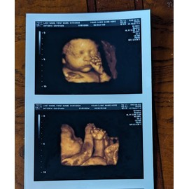 Prank 3D COLOR Customized Fake Ultrasound Strip of 2 Photos