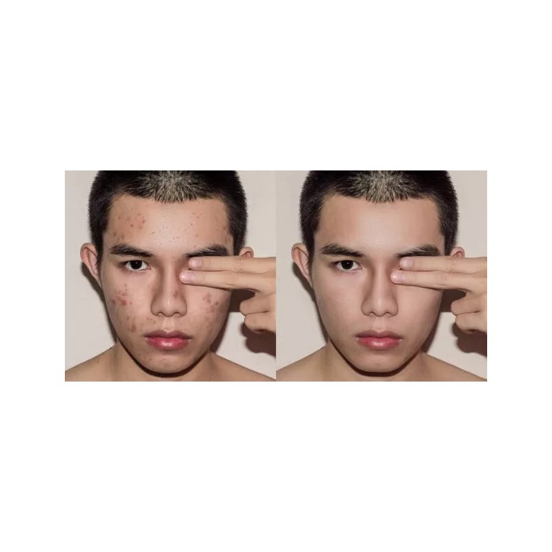 A3 Lemon Face Cream | Brightening & Control Stubborn Blemishes|400