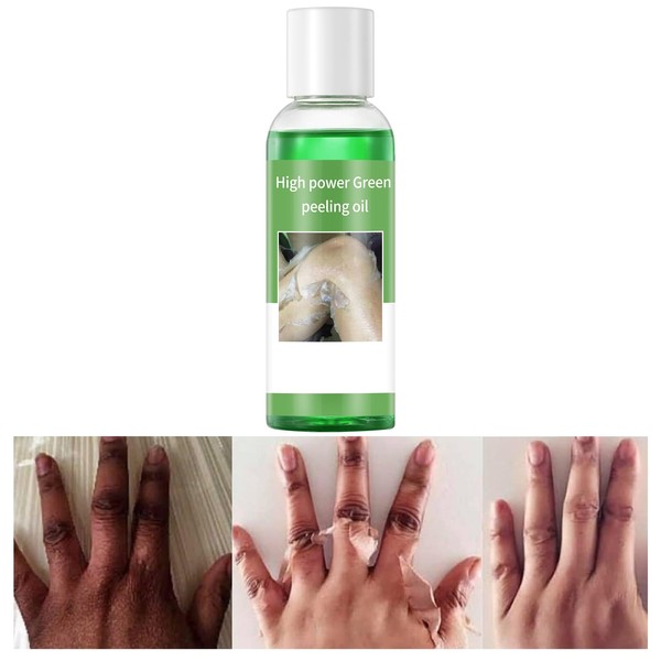 Peeling Oil for Dark Skin, Peeling Solution with Salicylic Acid,