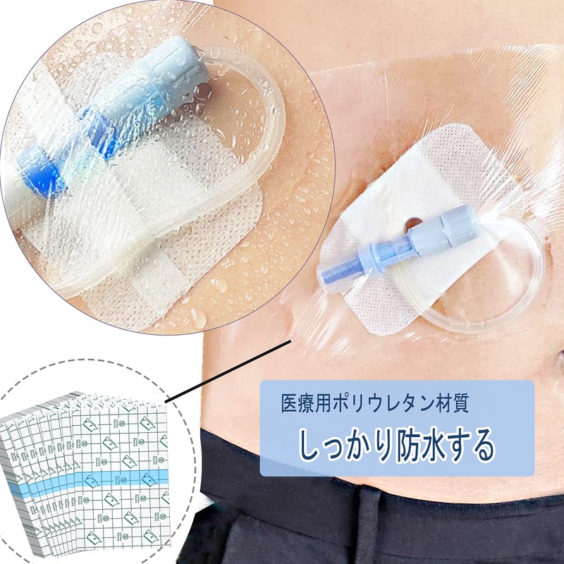 Abdominal Waterproof Film for Dialysis and Post-Surgery Wounds, Bath Use,