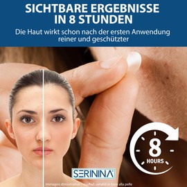 Pimple Patch Pickel Pflaster - 108 Akne-Patches in 2 Größen - Unsichtbares Hydrokolloid mit Salicylsäure und Teebaumöl - Ultra Dünn