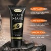 Mascarilla Negra Poros Puntos Negros Acné Todo Tipo De Piel