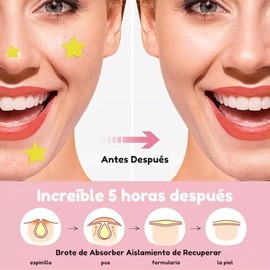 MAFAB  300 Parches Cubre Acne Figuras Estrella Corazones Mascarillas Anti Acne Espinillas Granos Barros Cuidado de la Piel Acido Salicilico Adhesivos 