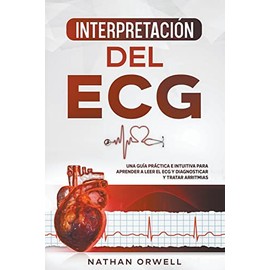 Interpretación del ECG: Una Guía Práctica e Intuitiva para Aprender a Leer el ECG y Diagnosticar y Tratar Arritmias