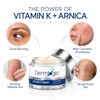 Vitamin K Cream- Moisturizing Bruise Healing Formula. Dark Spot Corrector