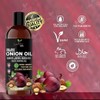 Generic Organic Onion Hair Growth Oil | Controls Hair Loss,