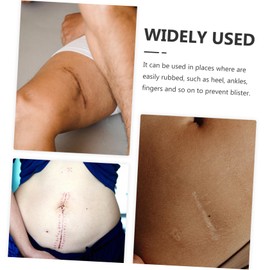 Healeved 6 Pcs Scar Removal Sheets Skin-friendly Scar Patches Scar Tapes Waterproof Tape Waterproof Duct Tape Strips Scar Removal Patches Tape for Scar