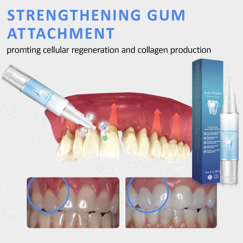 Landrain Gum Therapy Gel, Repair Gum Retention Pack of 5