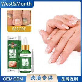West & Moon Concentrated Nail Brightening Liquid for Thick & Convex Nails Free Size/Style 1