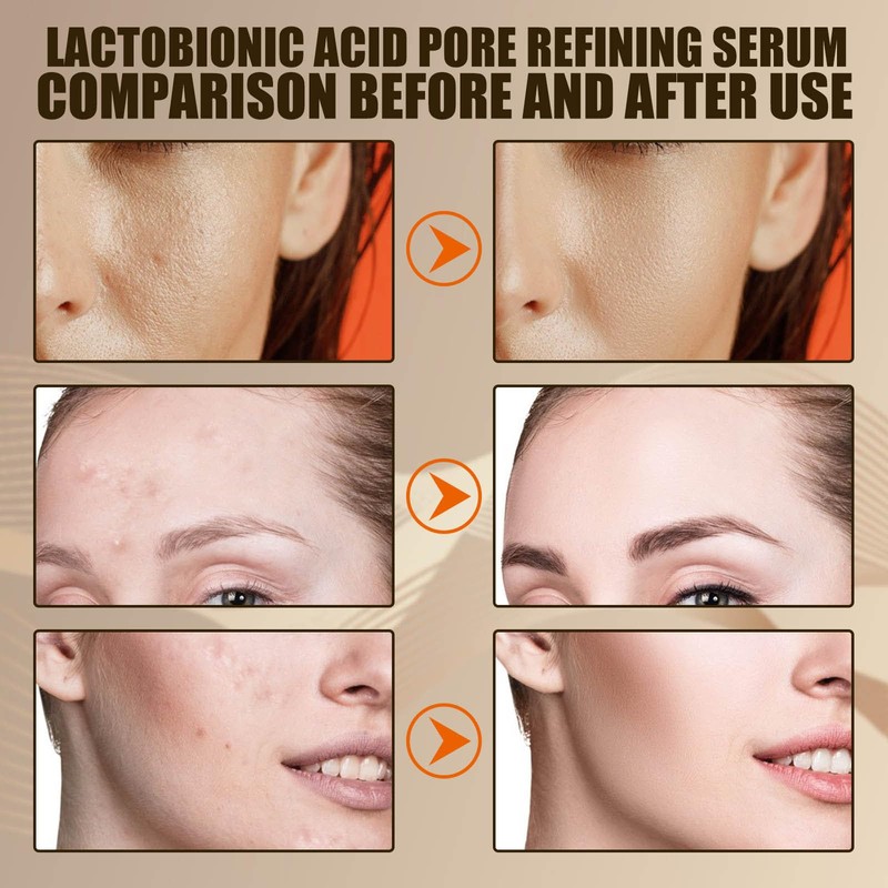 Lactobionic Acid Pore Refining Serum,Minimize Pores Serum Gentle Formula Clean