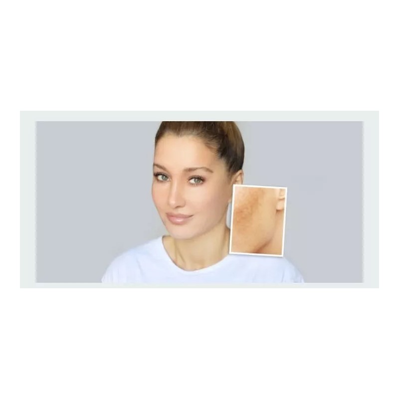 VITAMINA C SERUM Tratamiento Facial Humectacion Serum 100% Vitamina C