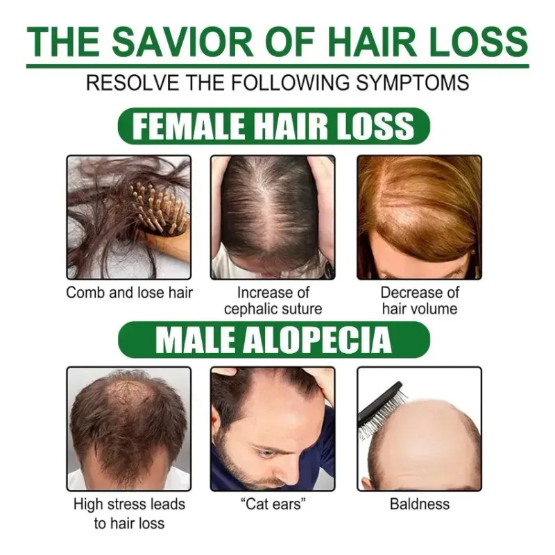 El Sérum Para El Crecimiento Del Cabello Promueve El Crecimi