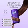 Feel Hair Support, Natural Support for Female Hair loss and