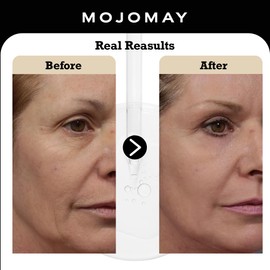 All in One Serum, Facial Serum, Bio Revive, Professional Anti-Aging, Skin Perfecting Regeneration, Brightening, Hydrating, Firming, Smoothing, Created by Dermatologists for All Skin Types, 1 OZ