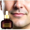 Beard mark removal serum, shaving mark whitening essence / 수염자국 제거 세럼 면도자국 미백 에센스