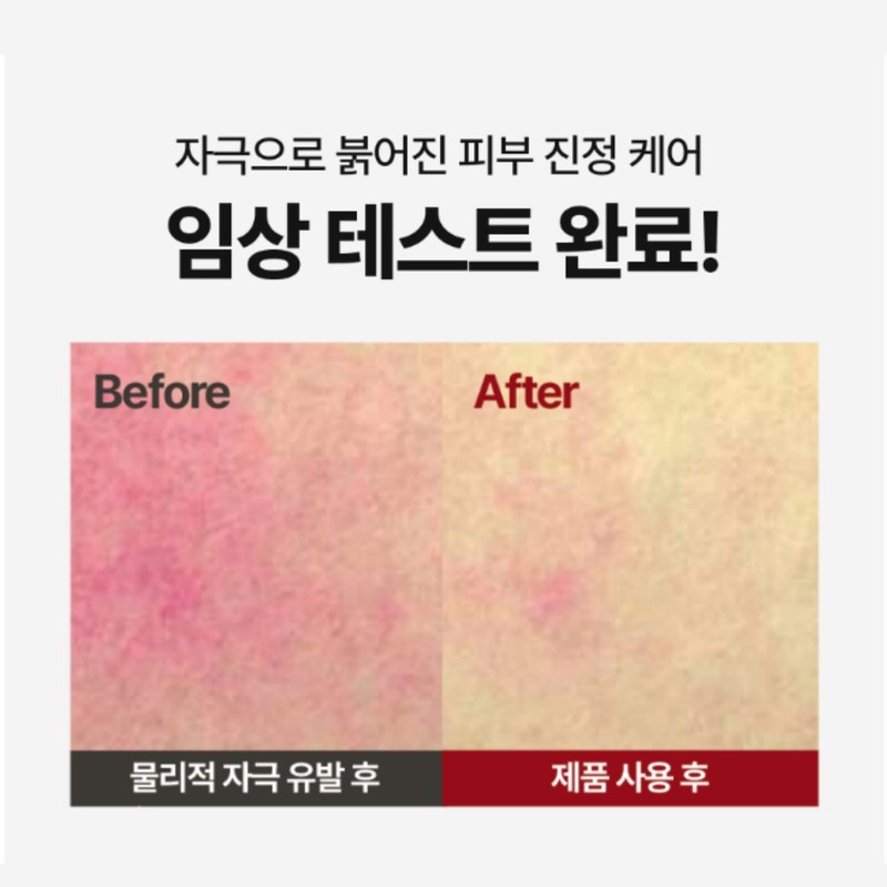 장벽 진정 보습 크림 PDRN 세라마이드 판테놀 엑소리쥬 세라콜지 242,