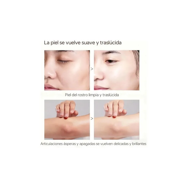 Quarxery Gel Exfoliante Purificante Gel Exfoliante Facial Corporal 4un